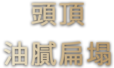 頭頂 油膩扁塌